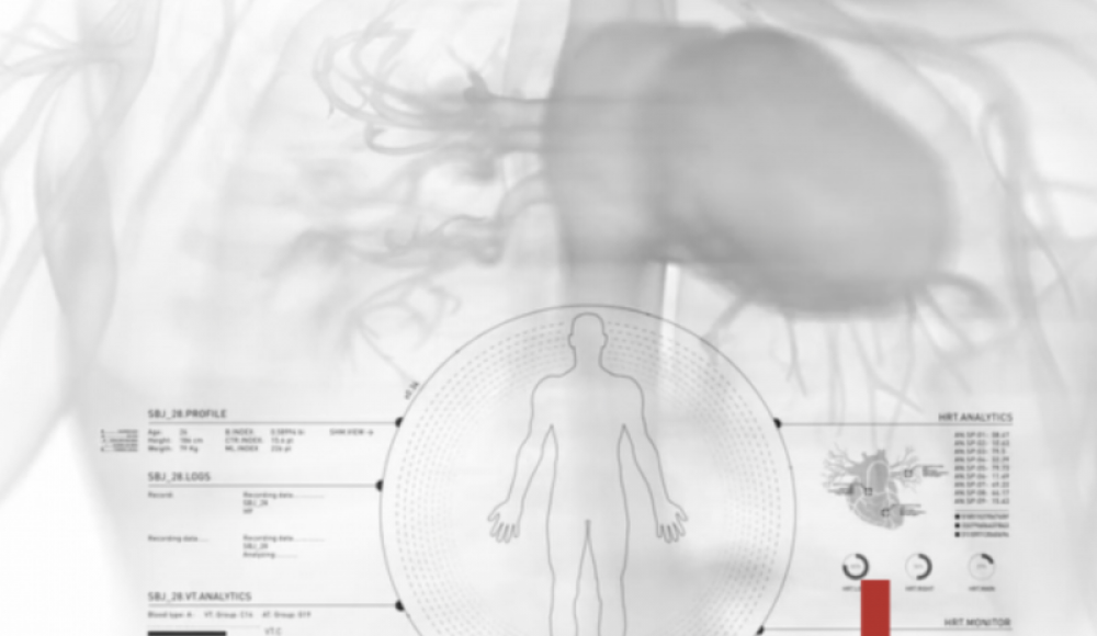 Израильская компания Nanox произвела революцию в области рентгена