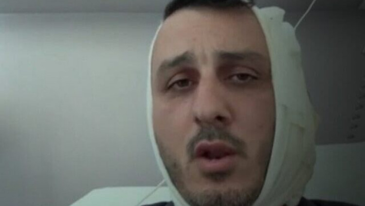 В Афинах сириец откусил израильтянину часть уха