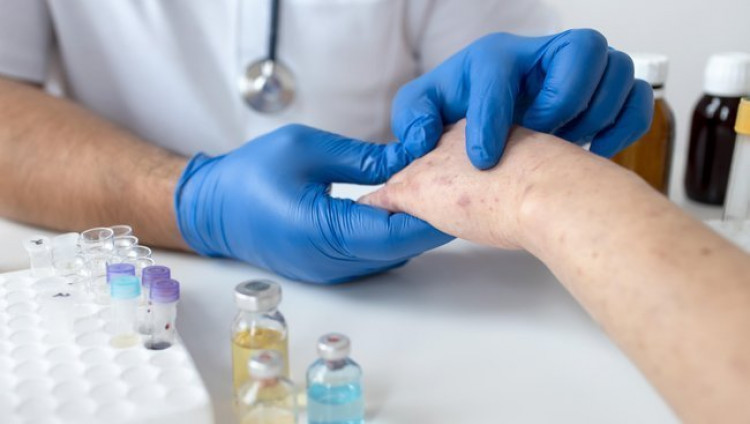 Вспышка кори в Израиле: 90% заболевших не были вакцинированы