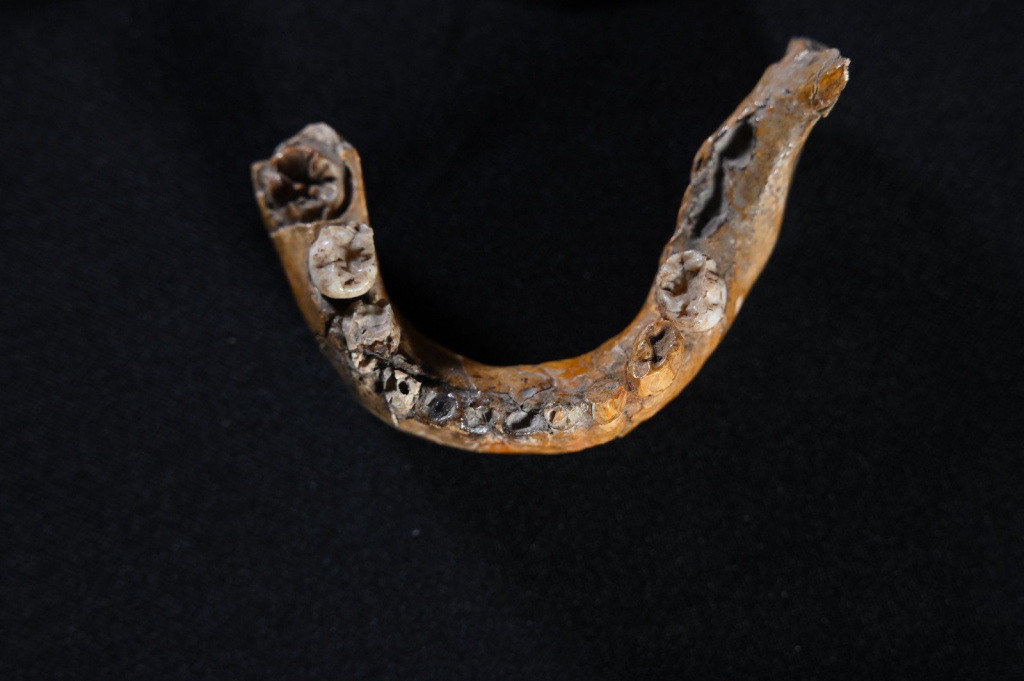 3.The-lower-jaw-of-Skhul-I-child-showing-features-characteristics-of-Neanderthals.jpeg