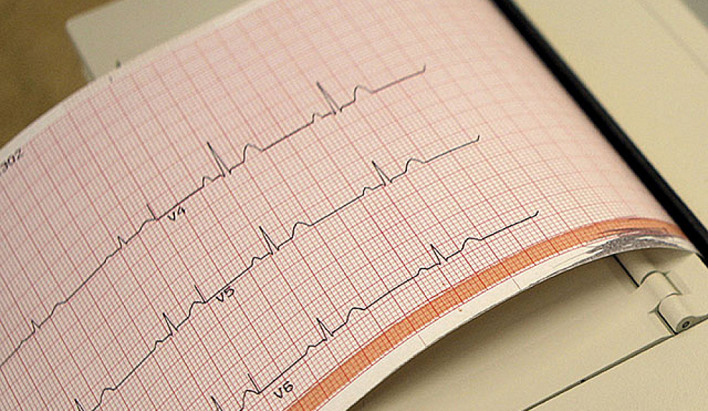 Израильские ученые научили ИИ читать электрокардиограммы и разъяснять диагноз