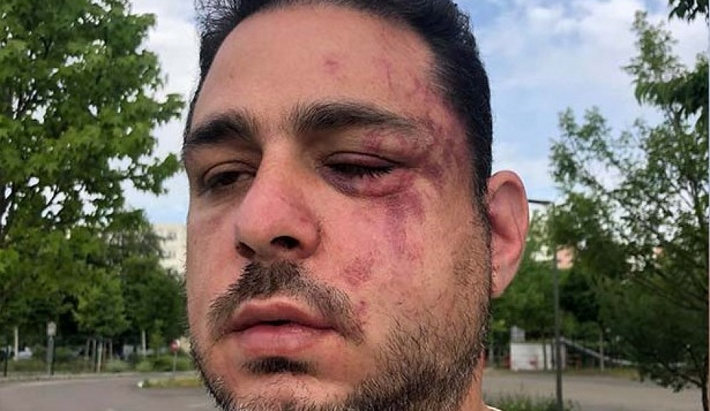 В Страсбурге еврея избили и подвергли антисемитским оскорблениям