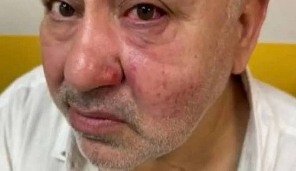В пригороде Парижа еврея избили за кипу и звезду Давида на шее